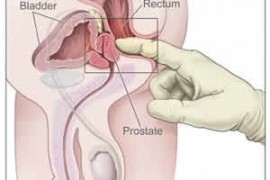 При кои състояния е подходящ масажът на простатата?