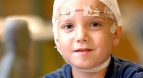 Епилепсия при деца – симптоми, лечение и лекарства