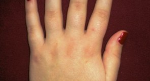 Болки в ръката – лечение и причини