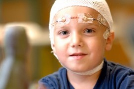 Епилепсия при деца – симптоми, лечение и лекарства